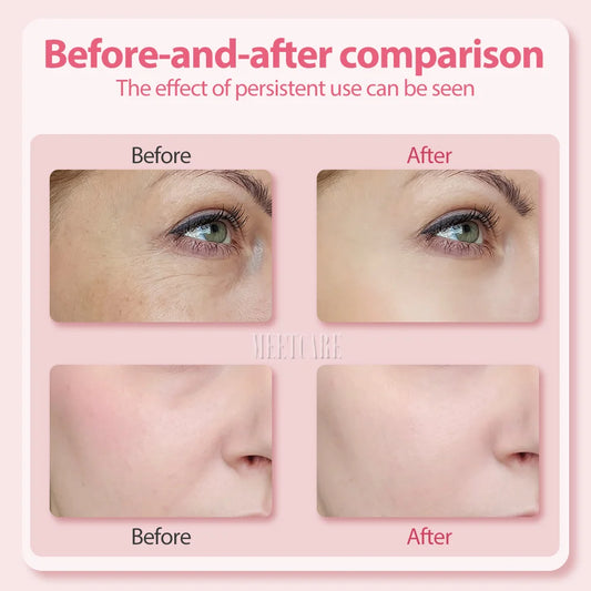 NADAVENO Eye Facial Massage