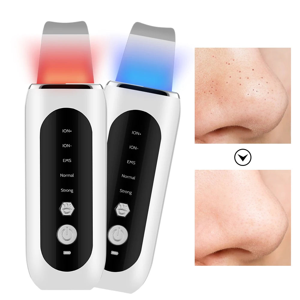Ultrasonic Skin Scrubber 5 Modes LED Red Blue Light EMS Face Lift Blackhead Remover Acne Pore Cleaning Peeling Machine Shovel